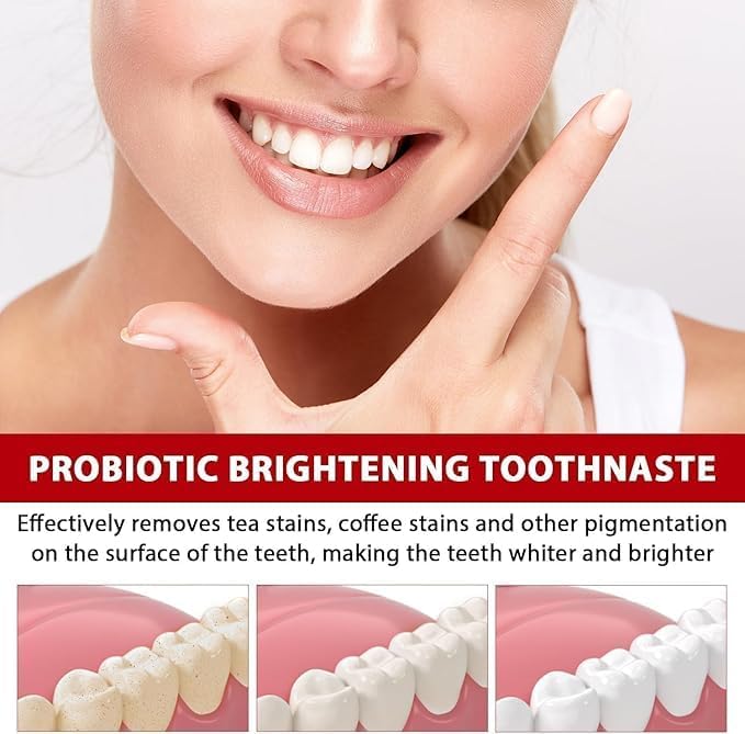 🔥SP4 Ultra Whitening Probiotic Toothpaste Buy 1 Get 1 Free 🔥