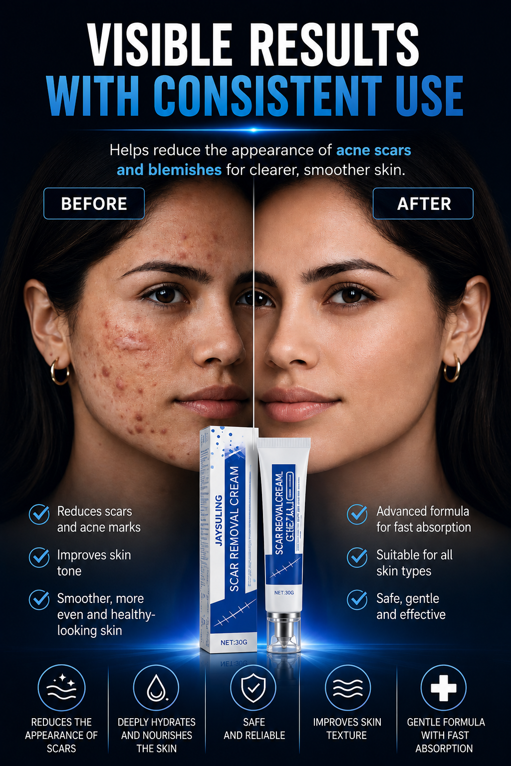 ScarSmooth™- Great for all types of marks | BUY 1 GET 1 FREE