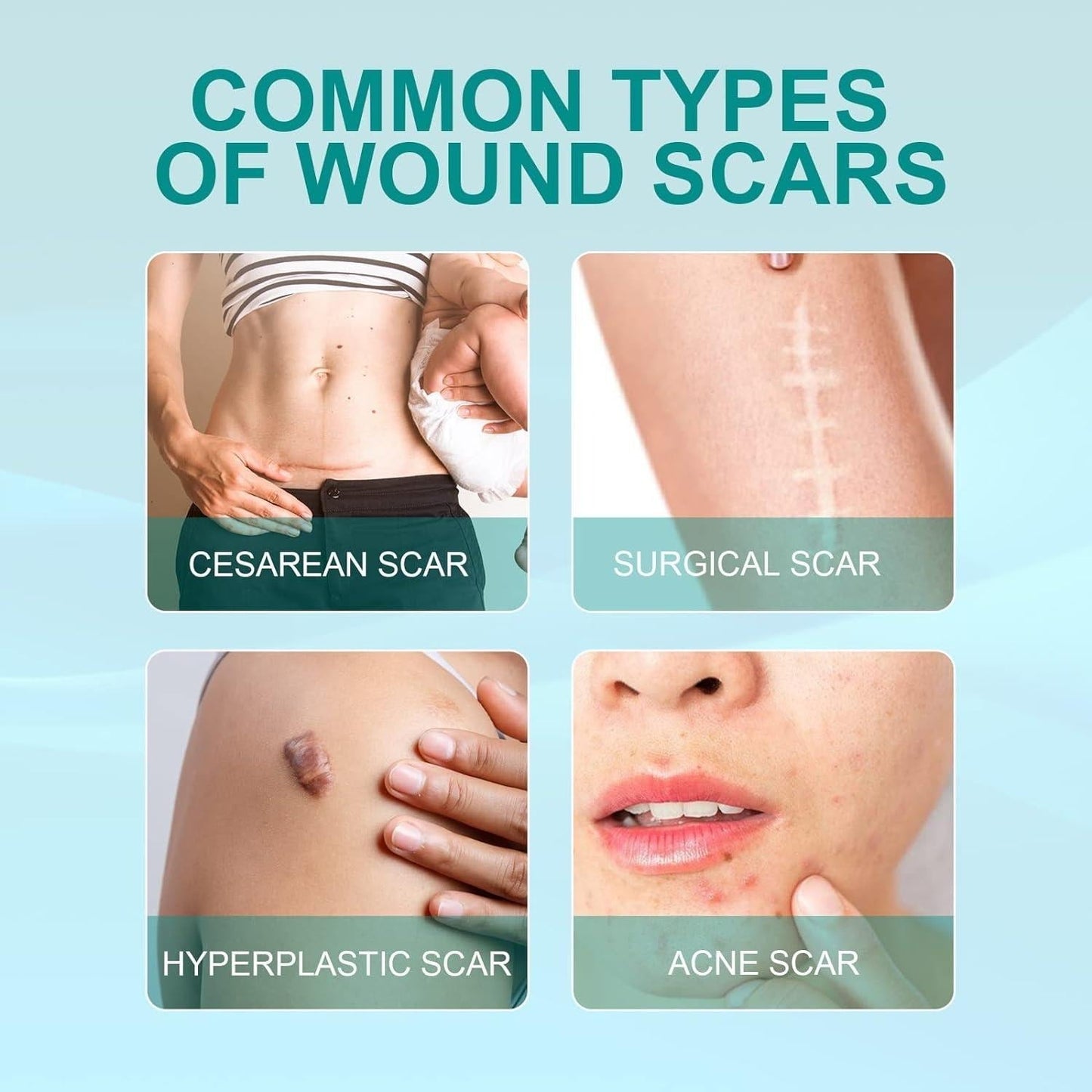 ProRegen Medical Scar Removal | Pack of 2